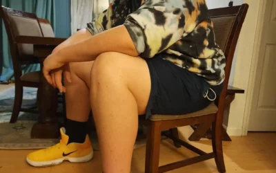 Eric Kilburn, the teenager with giant feet and hands