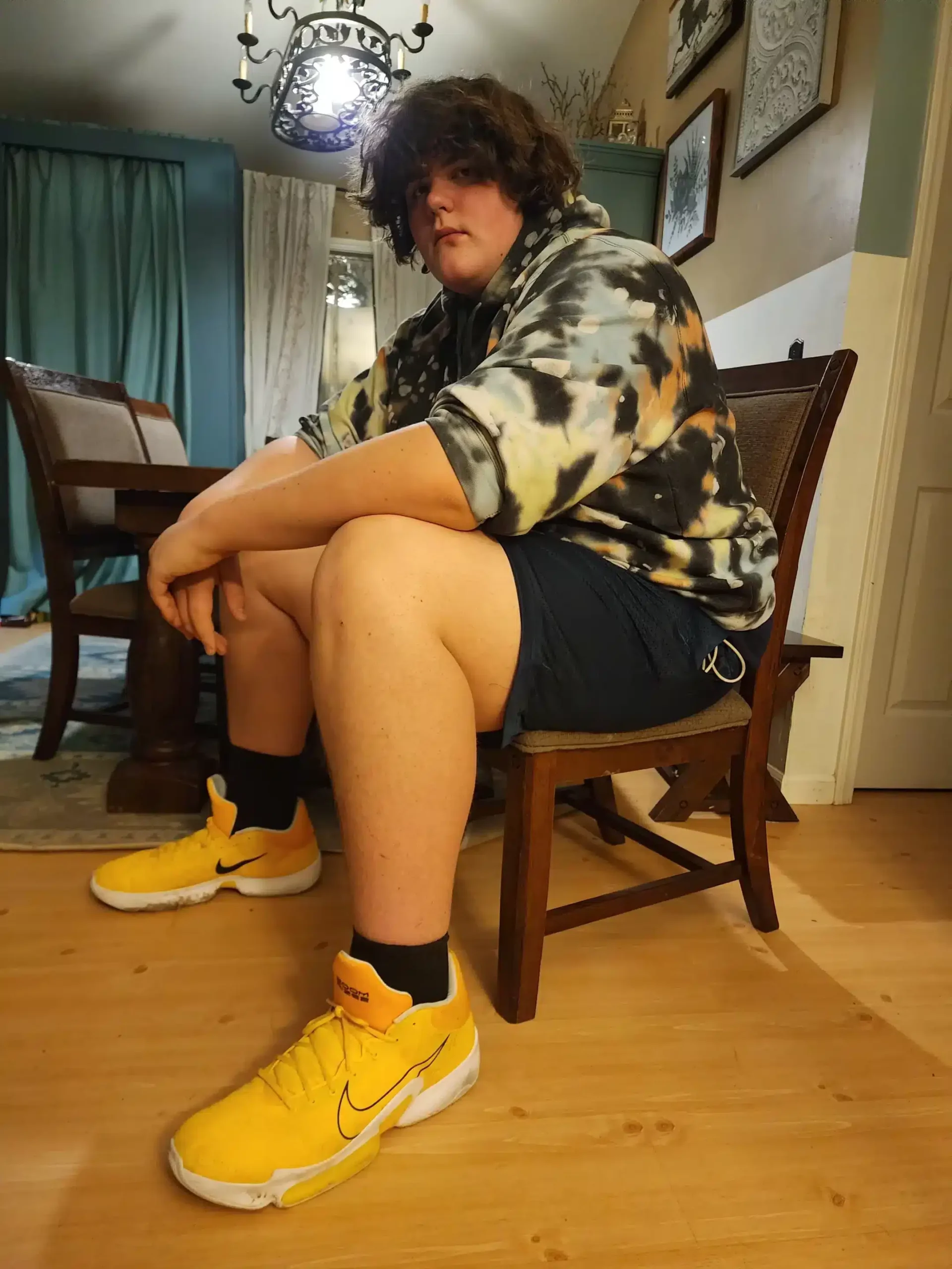 Eric Kilburn, the teenager with giants feets and hands