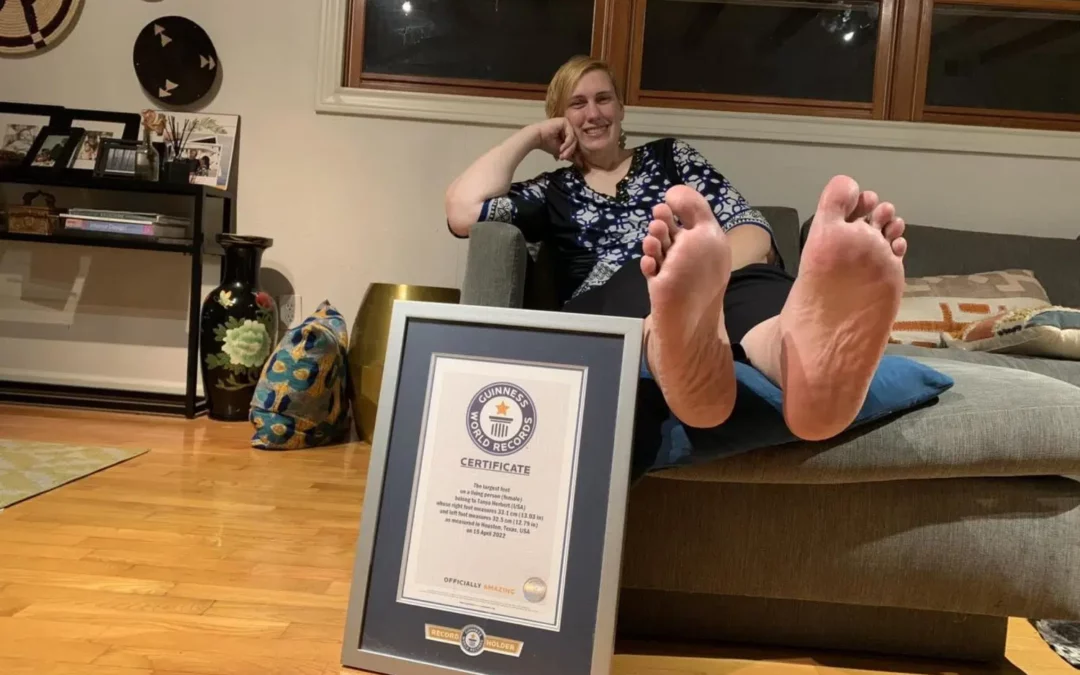Whot got the largest feet in the world ?